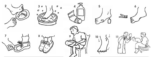 Chăm sóc bàn chân ở bệnh nhân đái tháo đường (Ảnh Internet)