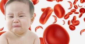 Nguyên nhân thiếu máu ở trẻ em và cách phòng tránh