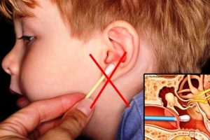 Ngoáy sâu vào tai trẻ có thể gây thủng màng nhĩ