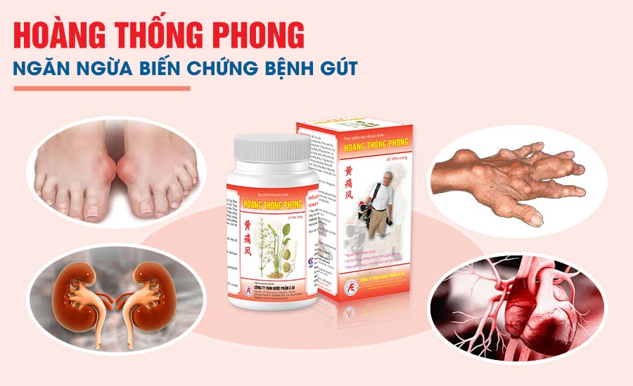 Hoàng Thống Phong giúp cải thiện bệnh gút, ngăn ngừa biến chứng