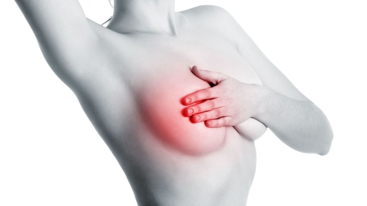 Dấu hiệu u nang buồng trứng có thể là đau vùng ngực