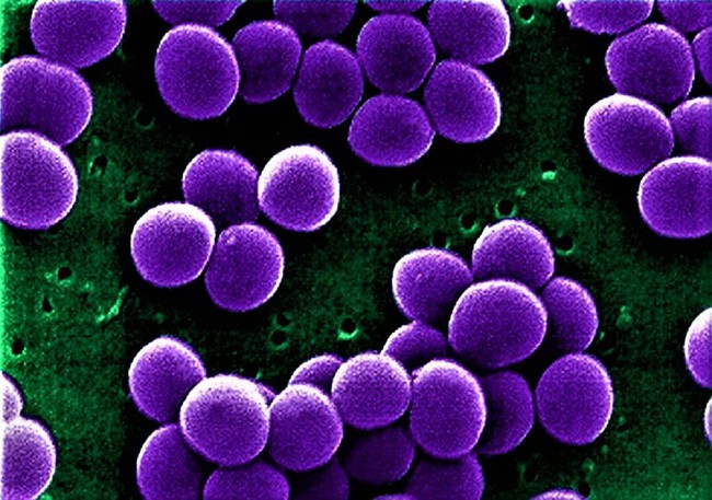 MRSA đề kháng với nhiều kháng sinh, nhưng cũng có kháng sinh có thể tiêu diệt vi khuẩn này