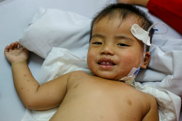 Bé Mạnh Hoan đã dần tỉnh táo và nhận ra bố mẹ sau một tuần điều trị ở khoa Hồi sức