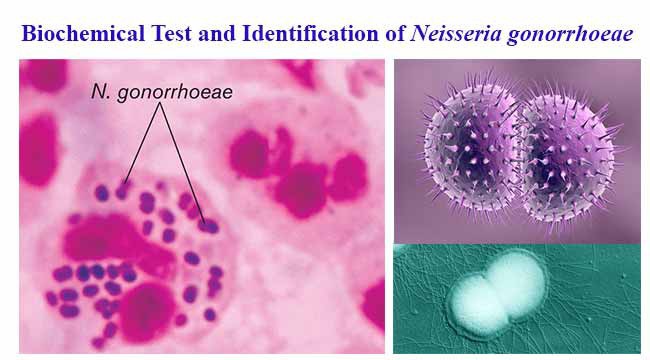 Neisseria Gonorrhoeae là tác nhân gây bệnh lậu lây truyền qua đường tình dục