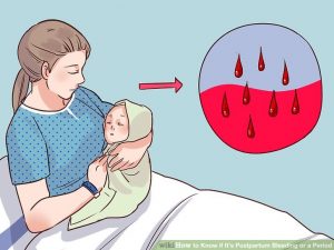 Sản dịch có thể có máu trong 1 tuần đầu sau sinh (Ảnh internet) 