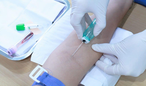 Xét nghiệm máu là một trong các phương pháp kiểm tra đường huyết