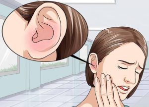 Phương pháp tây y trị ù tai