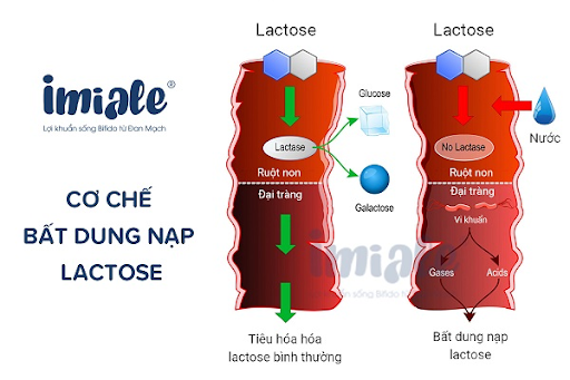 Quá trình tiêu hoá bình thường và trường hợp không dung nạp Lactose