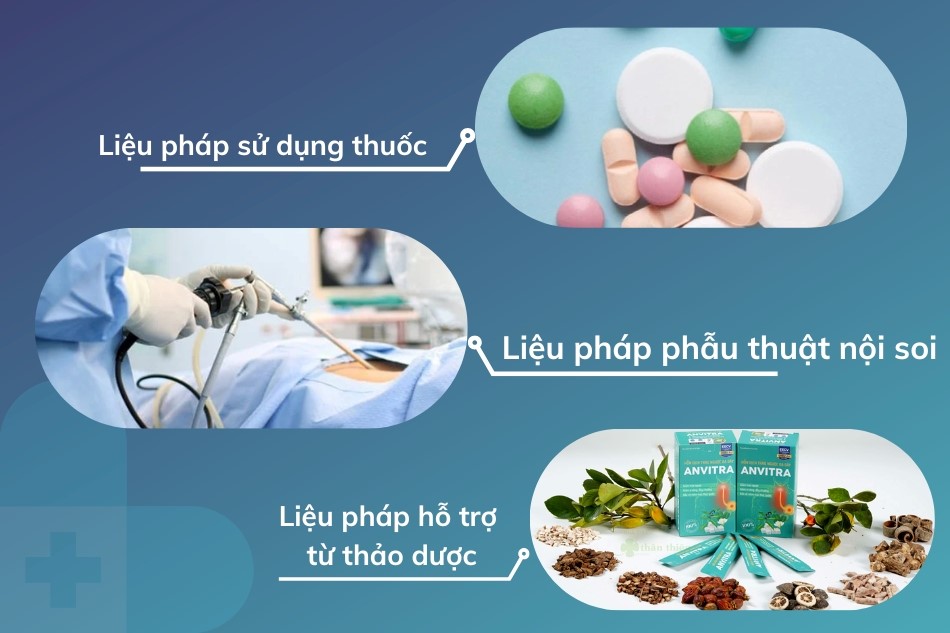 Liệu pháp sử dụng thuốc